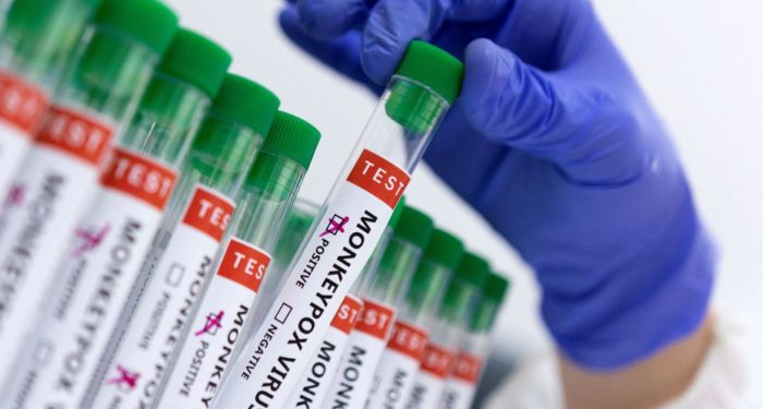 monkeypox no Estado do Rio: Entenda mais sobre a chegada da varíola dos macacos ao Brasil
