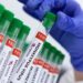monkeypox no Estado do Rio: Entenda mais sobre a chegada da varíola dos macacos ao Brasil