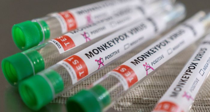 Monkeypox no Estado do RJ: Veja as cidades com casos registrados