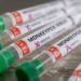 Monkeypox no Estado do RJ: Veja as cidades com casos registrados