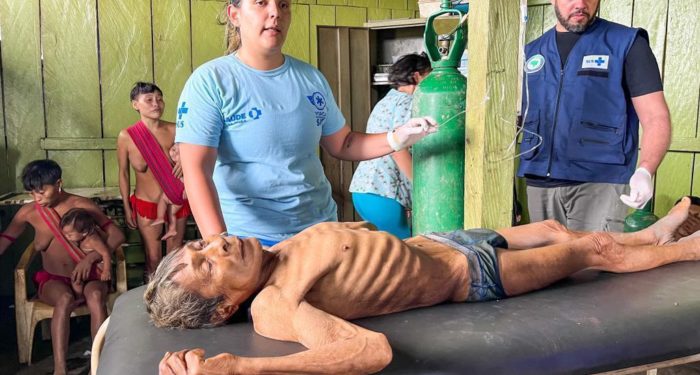 Mortes na tribo Yanomami: o que o MPF diz que a atuação do governo Bolsonaro.
