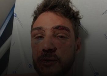 Brasileiros em Portugal: espancamento e tortura na Boate Titanic, em Lisboa