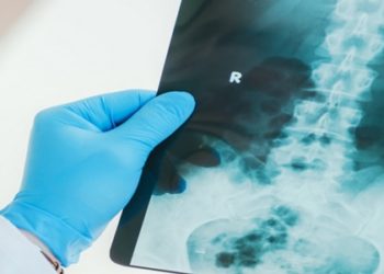O Serviço Nacional de Saúde (NHS) do Reino Unido introduziu novas regras para os radiologistas, que terão de verificar se suas pacientes estão grávidas, o que também se aplica aos homens, informou neste domingo o The Telegraph.