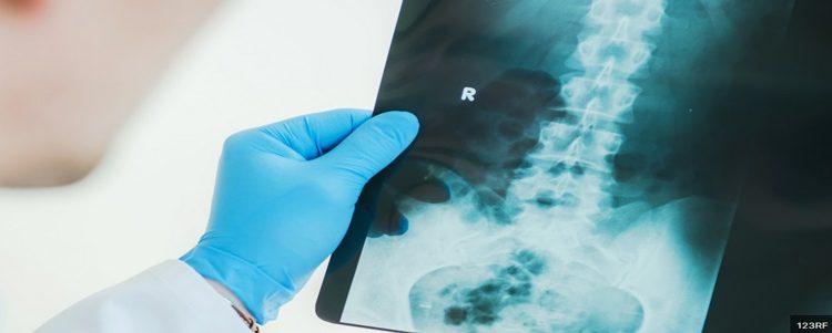 O Serviço Nacional de Saúde (NHS) do Reino Unido introduziu novas regras para os radiologistas, que terão de verificar se suas pacientes estão grávidas, o que também se aplica aos homens, informou neste domingo o The Telegraph.