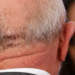 Lula recebe liberação médica para viajar de avião