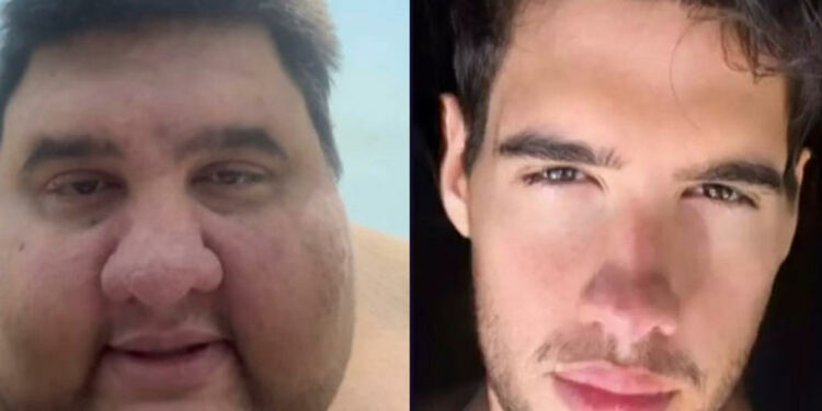 Influenciador Gabriel Freitas: morte por obesidade mórbida.