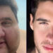 Influenciador Gabriel Freitas: morte por obesidade mórbida.