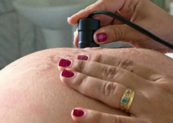 Dia Mundial da Saúde: campanha defende bem-estar materno e neonatal