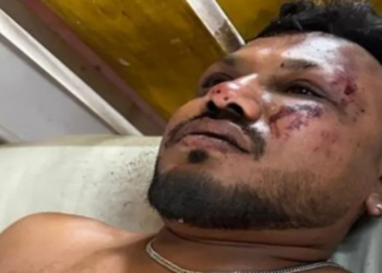 Ramesh Viswashkumar, único sobrevivente conhecido da queda do avião da Air India em Ahmedabad, conseguiu escapar por uma saída de emergência. Mais de 240 morreram no pior acidente aéreo em uma década.