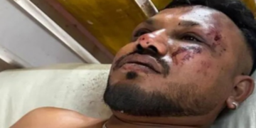 Ramesh Viswashkumar, único sobrevivente conhecido da queda do avião da Air India em Ahmedabad, conseguiu escapar por uma saída de emergência. Mais de 240 morreram no pior acidente aéreo em uma década.