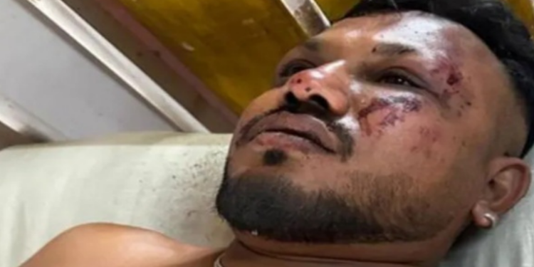 Ramesh Viswashkumar, único sobrevivente conhecido da queda do avião da Air India em Ahmedabad, conseguiu escapar por uma saída de emergência. Mais de 240 morreram no pior acidente aéreo em uma década.
