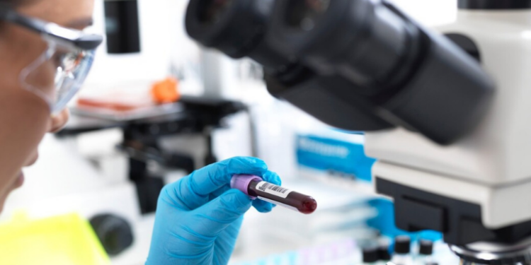 Pesquisadores da USP identificam proteínas e vias de sinalização que podem potencializar a eficácia da terapia CAR-T no combate a leucemias e linfomas. Estudo representa avanço na imunoterapia.