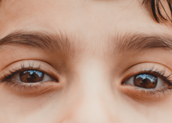 A leucocoria, conhecida como pupila branca, pode ser um sinal de doenças graves, como catarata congênita ou retinoblastoma. A detecção precoce é vital para o tratamento. Entenda a importância do reflexo vermelho.