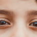 A leucocoria, conhecida como pupila branca, pode ser um sinal de doenças graves, como catarata congênita ou retinoblastoma. A detecção precoce é vital para o tratamento. Entenda a importância do reflexo vermelho.