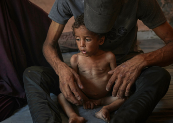 OMS registra recorde de casos mensais de desnutrição infantil aguda em Gaza. MSF, UNICEF e IPC alertam que a situação humanitária tende a piorar com o bloqueio e colapso dos serviços essenciais.
