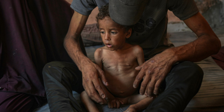 OMS registra recorde de casos mensais de desnutrição infantil aguda em Gaza. MSF, UNICEF e IPC alertam que a situação humanitária tende a piorar com o bloqueio e colapso dos serviços essenciais.