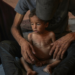 OMS registra recorde de casos mensais de desnutrição infantil aguda em Gaza. MSF, UNICEF e IPC alertam que a situação humanitária tende a piorar com o bloqueio e colapso dos serviços essenciais.