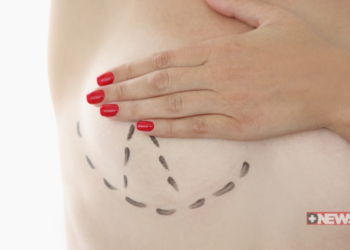 Mulheres com mutilação mamária terão acesso garantido à cirurgia reparadora mesmo sem diagnóstico de câncer. Nova lei inclui cobertura psicológica e liberdade de escolha no tratamento.