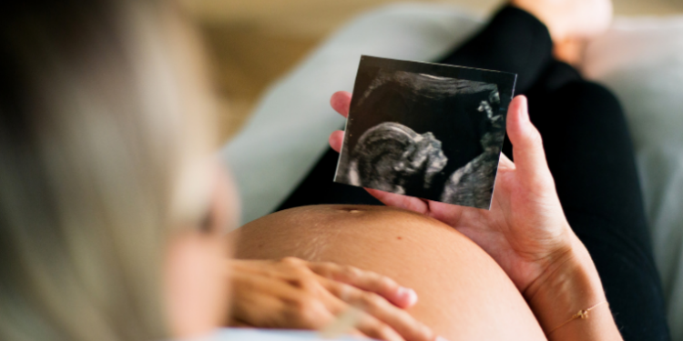 FDA vai emitir alerta sobre riscos do paracetamol na gravidez após estudos indicarem associação com autismo e TDAH, segundo Robert F. Kennedy Jr.