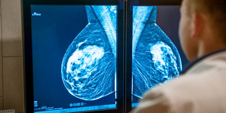 SUS passa a oferecer mamografia para mulheres de 40 a 49 anos. Governo amplia rastreamento, exames e tratamento contra o câncer de mama no Brasil.
