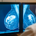SUS passa a oferecer mamografia para mulheres de 40 a 49 anos. Governo amplia rastreamento, exames e tratamento contra o câncer de mama no Brasil.