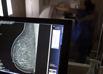 Ministério da Saúde amplia acesso à mamografia no SUS para mulheres a partir dos 40 anos, estende rastreamento até os 74, anuncia novas carretas de saúde e medicamentos modernos contra o câncer de mama.