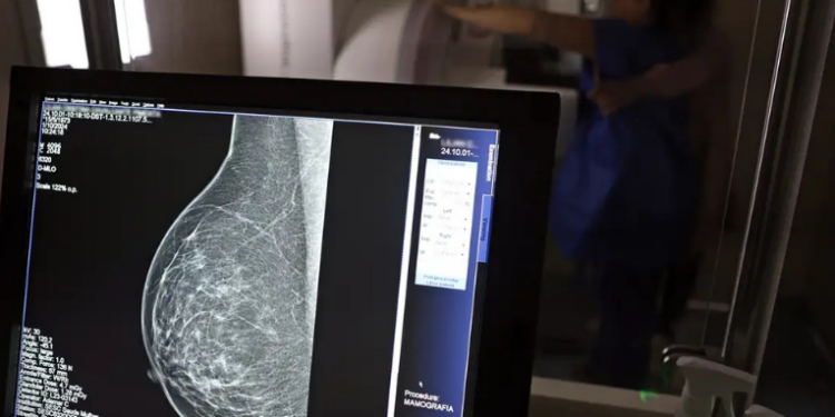 Ministério da Saúde amplia acesso à mamografia no SUS para mulheres a partir dos 40 anos, estende rastreamento até os 74, anuncia novas carretas de saúde e medicamentos modernos contra o câncer de mama.