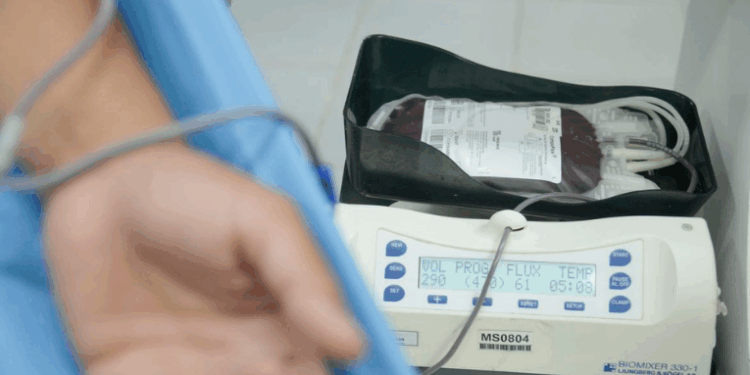 O Ministério da Saúde anunciou que o SUS deve ampliar o uso do Emicizumabe para crianças com hemofilia até seis anos, oferecendo tratamento mais simples e eficaz para prevenir sangramentos.