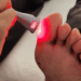 Estudo inédito mostra que a terapia com luz de LED estimula a regeneração dos tecidos e melhora o tratamento de feridas em pés diabéticos, oferecendo nova esperança a milhares de pacientes.