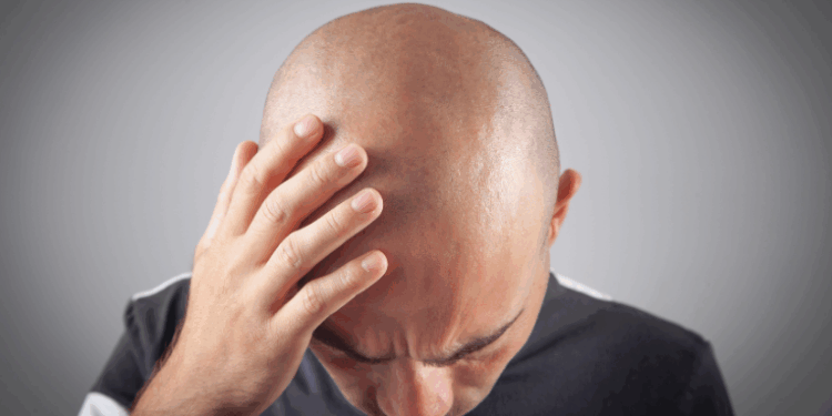 Estudo alerta para riscos de depressão e suicídio associados ao uso da finasterida, medicamento contra calvície. Pesquisadores pedem mais atenção aos efeitos psiquiátricos.
