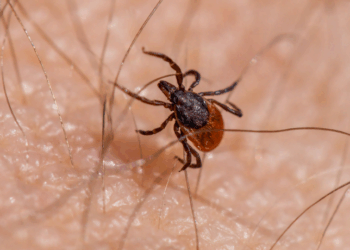 Após três mortes por febre maculosa, Salto (SP) interdita parque. Estado de São Paulo já soma 18 óbitos em 2025. Saiba como se proteger.