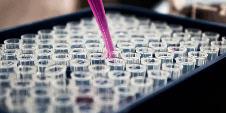Estudo brasileiro confirma o exame de sangue com biomarcador p-tau217 como método confiável para diagnosticar Alzheimer. Pesquisas apoiadas pelo Instituto Serrapilheira visam ampliar acesso pelo SUS, facilitando diagnóstico precoce.