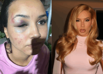 Vendedora da franquia WePink é agredida em shopping do Rio de Janeiro. Sindicato denuncia irregularidades trabalhistas e oferece suporte jurídico. Caso evidencia riscos à segurança de profissionais do comércio.