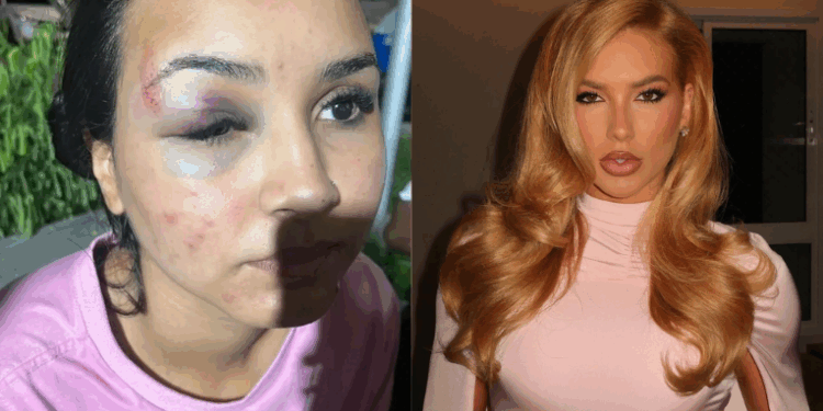 Vendedora da franquia WePink é agredida em shopping do Rio de Janeiro. Sindicato denuncia irregularidades trabalhistas e oferece suporte jurídico. Caso evidencia riscos à segurança de profissionais do comércio.