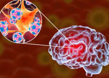 Baixada Santista registra 44 casos de meningite e sete óbitos em 2025. Autoridades de saúde orientam sobre sintomas, cuidados e prevenção da doença que pode ser viral ou bacteriana.