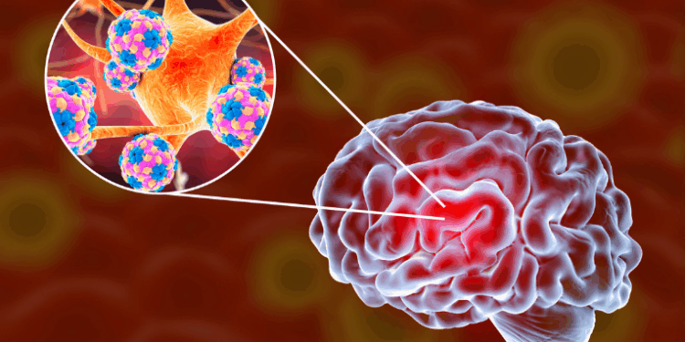 Baixada Santista registra 44 casos de meningite e sete óbitos em 2025. Autoridades de saúde orientam sobre sintomas, cuidados e prevenção da doença que pode ser viral ou bacteriana.
