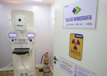 Lei sancionada garante mamografia gratuita no SUS para mulheres a partir dos 40 anos, ampliando o rastreamento precoce do câncer de mama no Brasil.