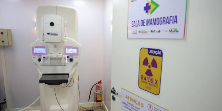 Lei sancionada garante mamografia gratuita no SUS para mulheres a partir dos 40 anos, ampliando o rastreamento precoce do câncer de mama no Brasil.