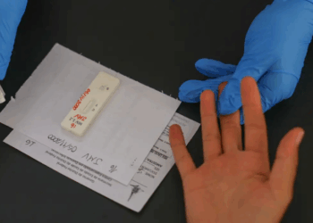 Ministério da Saúde intensifica prevenção ao HIV, ampliando PrEP e debatendo acesso ao lenacapavir, antirretroviral inovador. Brasil registra queda de mortes por Aids e se aproxima das metas globais.
