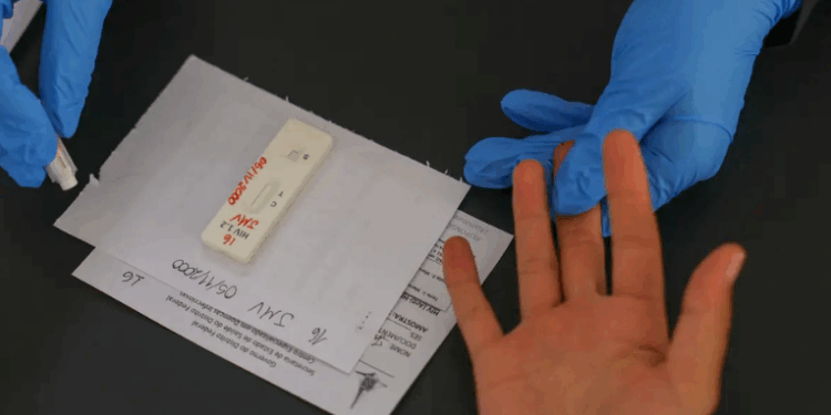 Ministério da Saúde intensifica prevenção ao HIV, ampliando PrEP e debatendo acesso ao lenacapavir, antirretroviral inovador. Brasil registra queda de mortes por Aids e se aproxima das metas globais.
