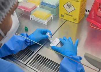 Anvisa aprova teste rápido brasileiro que identifica hantavirose em 20 minutos. Tecnologia da Fiocruz e UFRJ deve ampliar o diagnóstico precoce no SUS.
