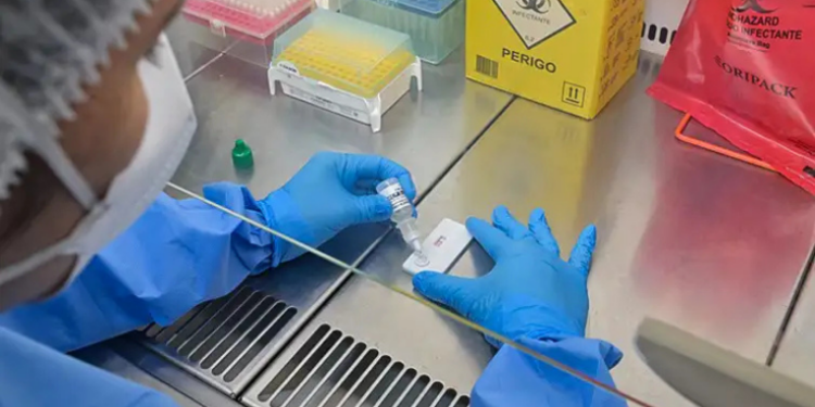 Anvisa aprova teste rápido brasileiro que identifica hantavirose em 20 minutos. Tecnologia da Fiocruz e UFRJ deve ampliar o diagnóstico precoce no SUS.