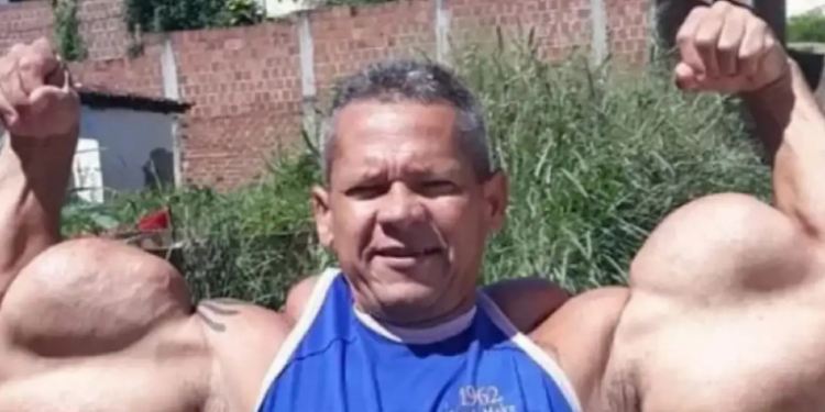 “Popeye Brasileiro” morre aos 55 anos no Recife