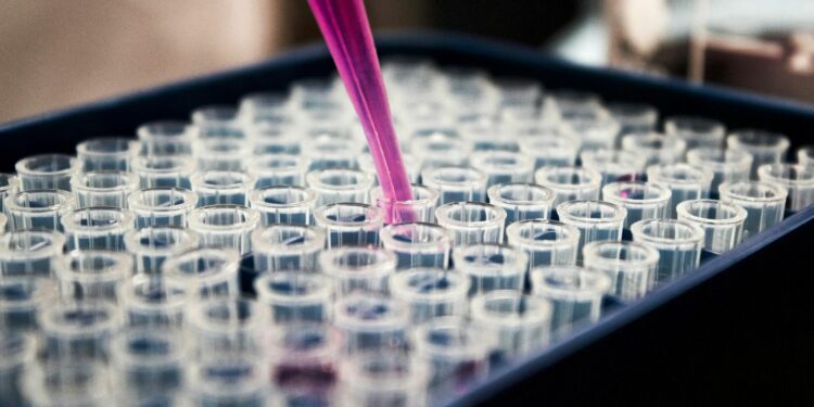 Estudo do Reino Unido indica que a menopausa está associada a mudanças cerebrais semelhantes às observadas no Alzheimer, especialmente em regiões da memória.