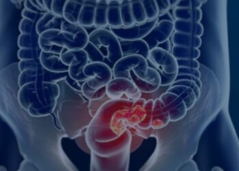 Estudos publicados na Nature Medicine mostram que transplantes fecais podem potencializar a imunoterapia em diferentes tipos de câncer.