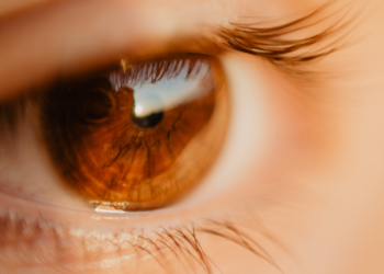 A fotoceratite, inflamação da córnea causada pelo sol, é comum no verão. Saiba como prevenir e proteger os olhos de lesões temporárias e complicações futuras.