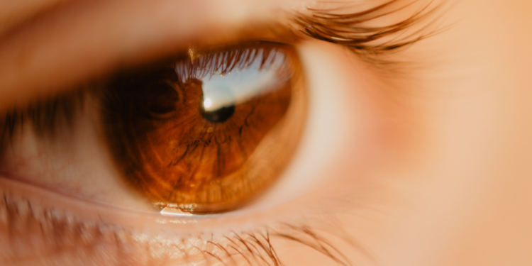 A fotoceratite, inflamação da córnea causada pelo sol, é comum no verão. Saiba como prevenir e proteger os olhos de lesões temporárias e complicações futuras.