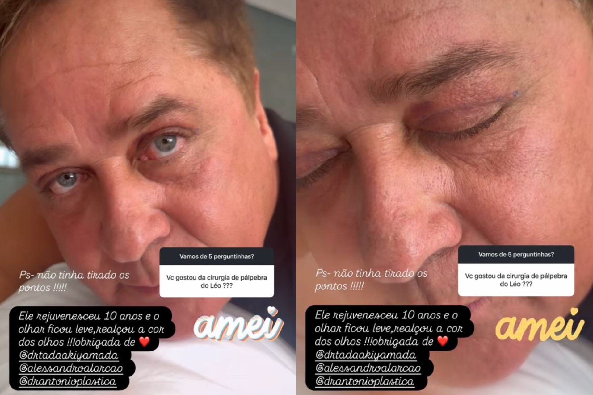 Imagem: Reprodução/ Redes Sociais
