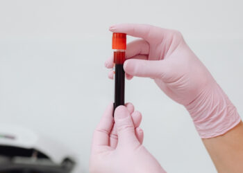 Estudo indica que exame de sangue pode auxiliar médicos na detecção de tumores cerebrais.