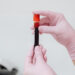 Estudo indica que exame de sangue pode auxiliar médicos na detecção de tumores cerebrais.